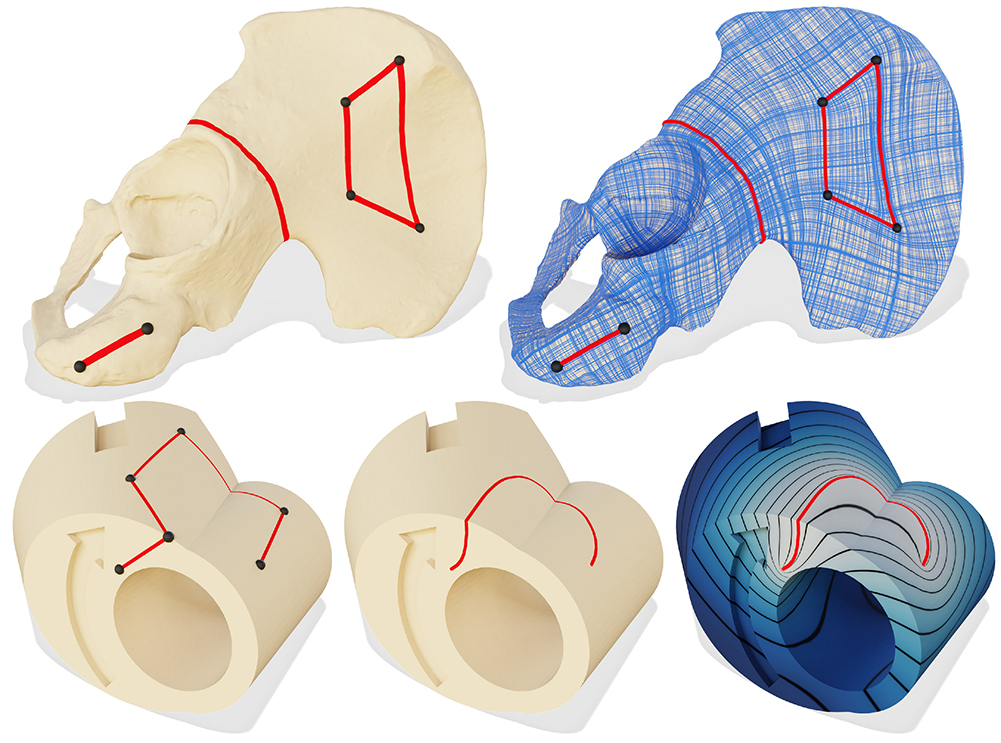 Our conforming intrinsic triangulations allow geodesic or Bézier curves to be used as boundary conditions for existing algorithms. Top: a smooth cross field on a scan of a human pelvis, aligned with exact geodesic curves constructed via FlipOut. The field is generated with [Knöppel et al. 2013]. Bottom: we construct a Bézier curve on a mechanical part, then solve a Poisson problem with boundary conditions along the curve.